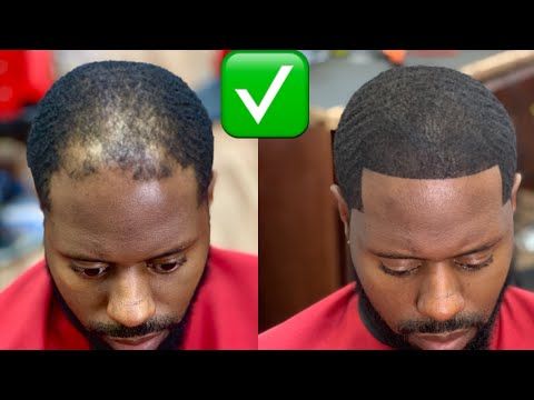 100% Pure Batana Oil – Restore Life to Your Hair