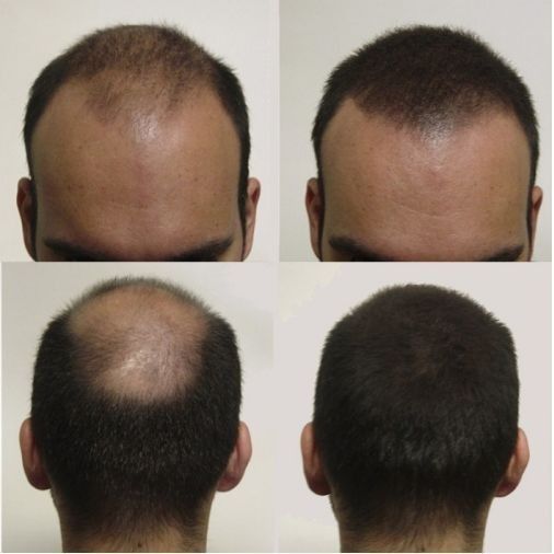 100% Pure Batana Oil – Restore Life to Your Hair