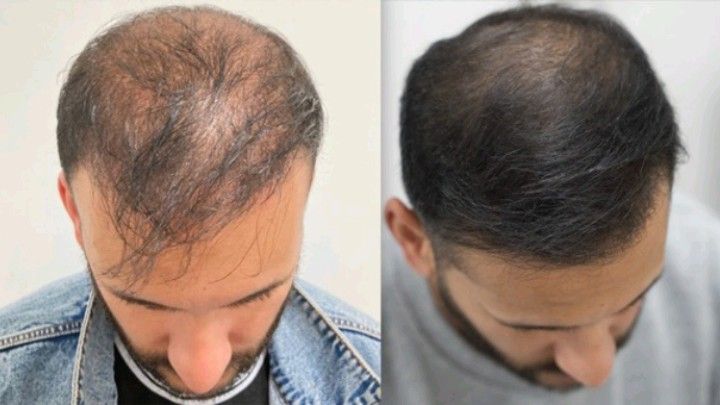 100% Pure Batana Oil – Restore Life to Your Hair